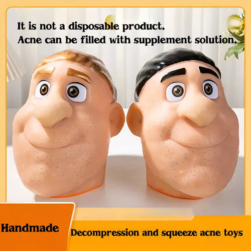 handcrafted squeeze acne fidget toy stress-reliever